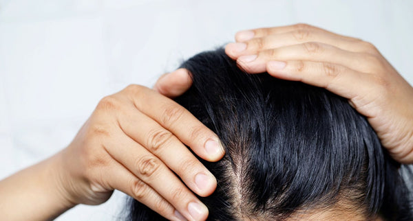 ¿Qué efecto tiene la ashwagandha sobre el cabello?